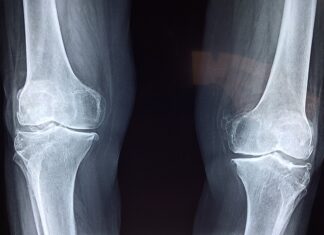 Jak prawidłowo spać na poduszce ortopedycznej?